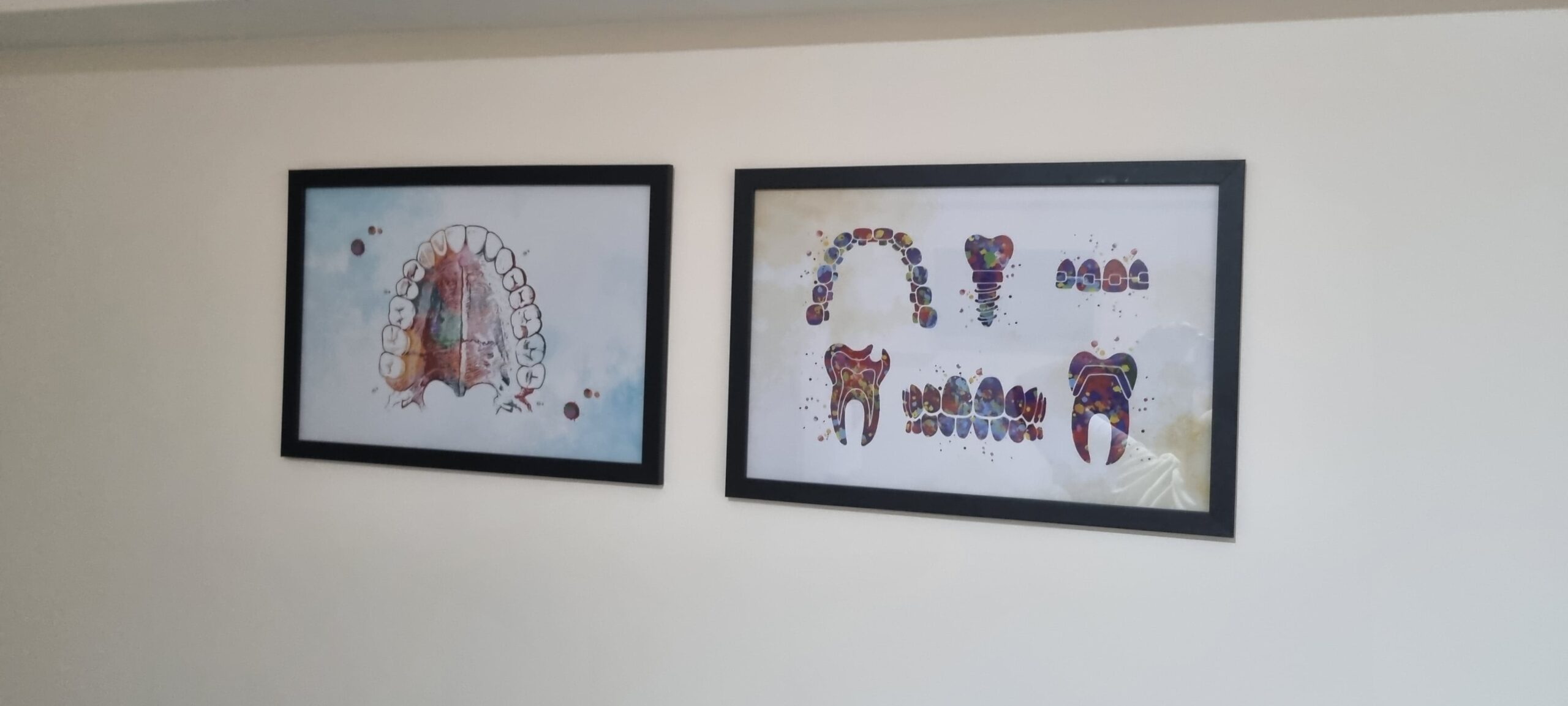 Extração dentária